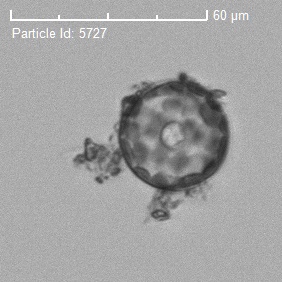 圓篩藻(硅藻門).jpg 圓篩藻(硅藻門).jpg