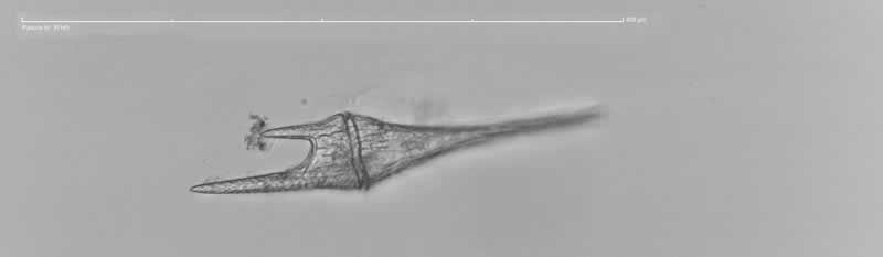 角甲藻.jpg 角甲藻.jpg