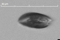 嚙蝕隱藻Cryptomons erosa.jpg 嚙蝕隱藻Cryptomons erosa.jpg